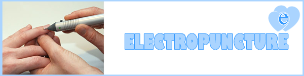 ELECTROPUNCTURE